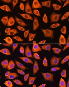 Immunofluorescence analysis of L929 cells using Anti-LASP1 Antibody (A11701) at a dilution of 1:100 (40X lens). DAPI was used to stain the cell nuclei (blue)