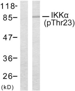 Western blot analysis of lysates from MDA-MB-435 cells treated with EGF using Anti-IKK-alpha (phospho Thr23) Antibody. The left hand lane represents a negative control, where the antibody is blocked by the immunising peptide