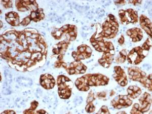 Immunohistochemical analysis of formalin-fixed, paraffin-embedded human kidney tissue using Anti-CD10 Antibody [MME/6461]