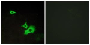 Anti-ETBR2 antibody