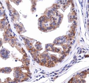 Anti-NBR1 Rabbit Polyclonal Antibody