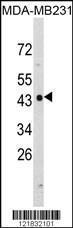 Anti-N-myc Downstream Regulated Gene 1 Protein Rabbit Polyclonal Antibody