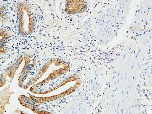 Immunohistochemical analysis of paraffin-embedded human gallbladder using Anti-MMP-7 Antibody