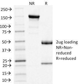 SDS-PAGE analysis of Anti-Clathrin Light Chain Antibody [CLC/1421] under non-reduced and reduced conditions; showing intact IgG and intact heavy and light chains, respectively. SDS-PAGE analysis confirms the integrity and purity of the antibody.