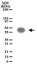 Anti-ATF2 Rabbit Polyclonal Antibody