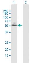 Anti-PARP15 Mouse Polyclonal Antibody