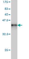 Anti-XPC Mouse Monoclonal Antibody [clone: 6D11]