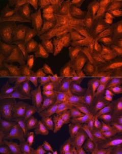 Immunofluorescence analysis of U-2 OS cells using Anti-LASP1 Antibody (A11701) at a dilution of 1:100 (40X lens). DAPI was used to stain the cell nuclei (blue)