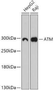 Western blot analysis of extracts of various cell lines, using Anti-ATM Antibody (A305537) at 1:1,000 dilution