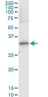 Anti-RYBP Antibody Pair