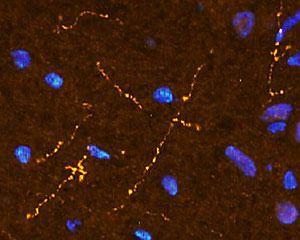 Immunohistochemical staining in rat brainstem medulla. 4% paraformaldehyde fixed rat brain crystostat sections (10 µm) were incubated overnight at 4°C with Rabbit polyclonal antibody to human Somatostatin (10 µg/ml).