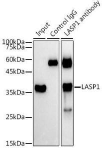 Immunoprecipitation analysis of 300 µg extracts of A-549 cells using 3 µg of Anti-LASP1 Antibody (A11701). This Western blot was performed on the immunoprecipitate using Anti-LASP1 Antibody (A11701) at a dilution of 1:1000