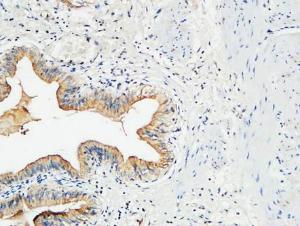 Immunohistochemical analysis of paraffin-embedded human gallbladder using Anti-MMP-7 Antibody