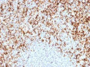 Immunohistochemical analysis of formalin-fixed, paraffin-embedded human spleen using Anti-Integrin beta 3 Antibody [ITGB3/2597]