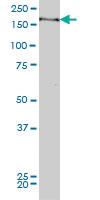 Anti-MYPN Mouse Monoclonal Antibody [clone: 4C8]