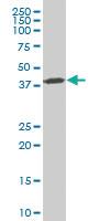 Anti-FRA10AC1 Mouse Polyclonal Antibody