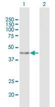 Anti-PARP15 Mouse Polyclonal Antibody