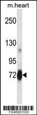 Anti-PLK2 Rabbit Polyclonal Antibody (APC (Allophycocyanin))