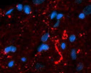 Immunohistochemical staining in rat brainstem medulla. 4% paraformaldehyde fixed rat brain crystostat sections (10 µm) were incubated overnight at 4°C with Rabbit polyclonal antibody to human Neurotensin (10 µg/ml).