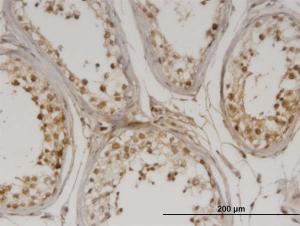 Anti-DMAP1 Mouse Monoclonal Antibody [clone: 2G12]