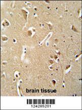 Anti-CILP2 Rabbit Polyclonal Antibody (AP (Alkaline Phosphatase))