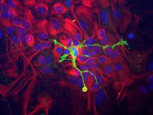 Immunocytochemistry of a mixed neuron/glial culture from newborn rat brain stained with Anti-Coronin 1a Antibody (1:10000 / green) and Anti-Vimentin Antibody (A85421 / 1:10000 / red)