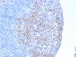 Immunohistochemical analysis of formalin-fixed, paraffin-embedded human kidney tissue using Anti-CD10 Antibody [MME/6461]