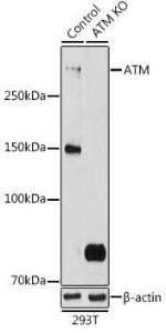 Western blot analysis of extracts from normal (control) and ATM knockout (KO) 293T cells, using Anti-ATM Antibody (A305537) at 1:500 dilution