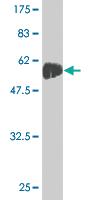 Anti-HIV1 gp120 Mouse Monoclonal Antibody [clone: 3F8]