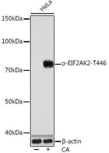 Western blot analysis of extracts of various cell lines, using Anti-PKR (phospho Thr446) Antibody [ARC0293] (A306474) at 1:1000 dilution. HeLa cells were treated by Calyculin A (100 nM) at 37°C for 30  minutes after serum-starvation overnight