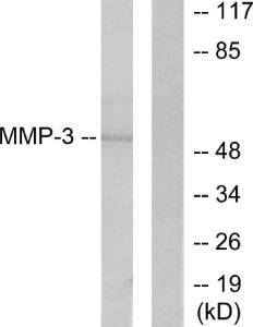 Western blot analysis of lysates from 293 cells using Anti-MMP-3 Antibody. The right hand lane represents a negative control, where the antibody is blocked by the immunising peptide