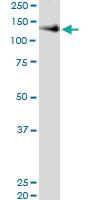 Anti-NCAM1 Polyclonal Antibody Pair