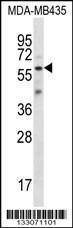 Anti-FSCN3 Rabbit Polyclonal Antibody (FITC (Fluorescein Isothiocyanate))