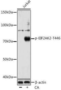 Western blot analysis of extracts of various cell lines, using Anti-PKR (phospho Thr446) Antibody [ARC0293] (A306474) at 1:1000 dilution. Jurkat cells were treated by Calyculin A (100 nM) at 37°C for 30  minutes