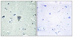 Anti-ETBR2 antibody