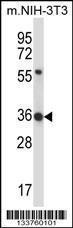 Anti-HEXIM1 Rabbit Polyclonal Antibody