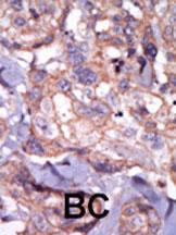 Anti-TXK Rabbit Polyclonal Antibody (PE (Phycoerythrin))