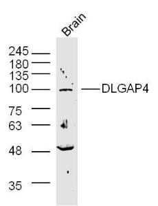 Rat brain lysates probed with SAPAP4/DLGAP4 Polyclonal Antibody, unconjugated (bs-12140R) at 1:300 overnight at 4°C followed by a conjugated secondary antibody at 1:10000 for 90 minutes at 37°C.