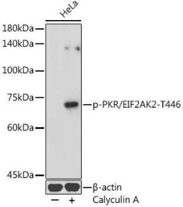 Western blot analysis of extracts of HeLa cells, using Anti-PKR (phospho Thr446) Antibody (A306475) at 1:1000 dilution