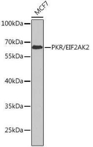 Anti-PKR Rabbit Polyclonal Antibody