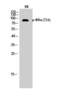 Western blot analysis of KB cells using Anti-IKK-alpha (phospho Thr23) Antibody