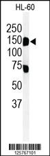 Anti-T131L Rabbit Polyclonal Antibody