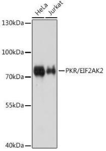 Anti-PKR Rabbit Polyclonal Antibody