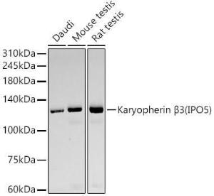 Western blot analysis of various lysates, using Anti-IPO5 Antibody [ARC59432] (A309391) at 1:10000 dilution