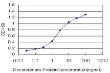 Anti-MYPN Mouse Monoclonal Antibody [clone: 4C8]