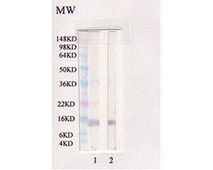 Western blot analysis of leptin in Human. Lane 1: Rabbit polyclonal antibody to human Leptin (BSENR-1552-100) at 1:1,000 Lane 2: Chicken polyclonal antibody to human Leptin (BSENC-1510-500) at 1:1,000