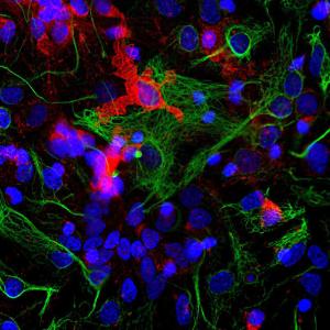 Immunofluorescent analysis of cortical neuron-glial cell culture from E20 rat stained with Anti-Coronin 1a Antibody (A85431), at a dilution of 1:1000 in red, and co-stained with Anti-GFAP Antibody (A85422), at a dilution of 1:1000 in green