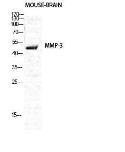 Western blot analysis of various cells using Anti-MMP-3 Antibody