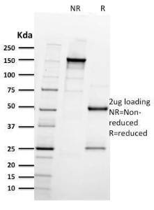 SDS-PAGE analysis of Anti-Integrin beta 3 Antibody [ITGB3/2597] under non-reduced and reduced conditions; showing intact IgG and intact heavy and light chains, respectively SDS-PAGE analysis confirms the integrity and purity of the antibody