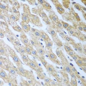 Anti-PKR Rabbit Polyclonal Antibody